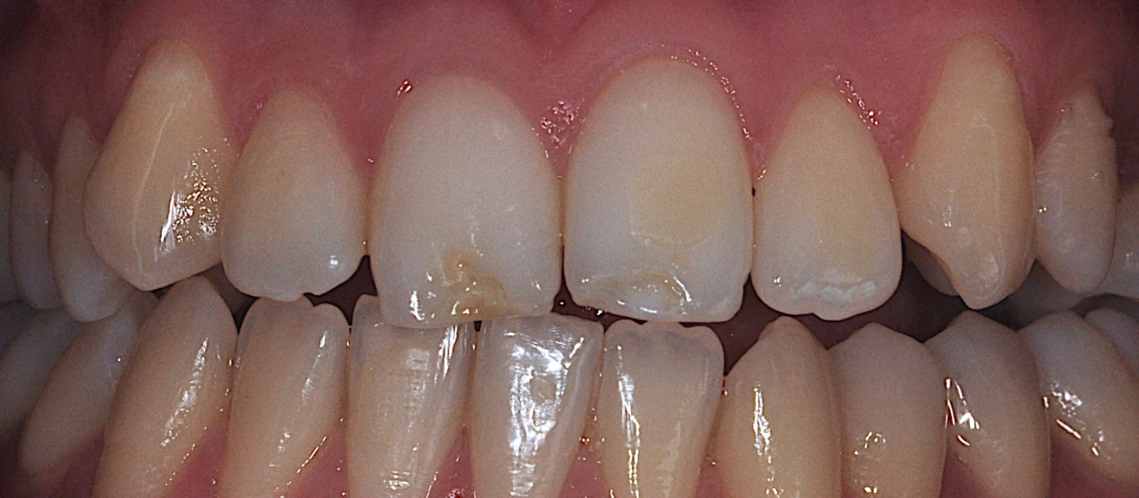 Orthodontics II