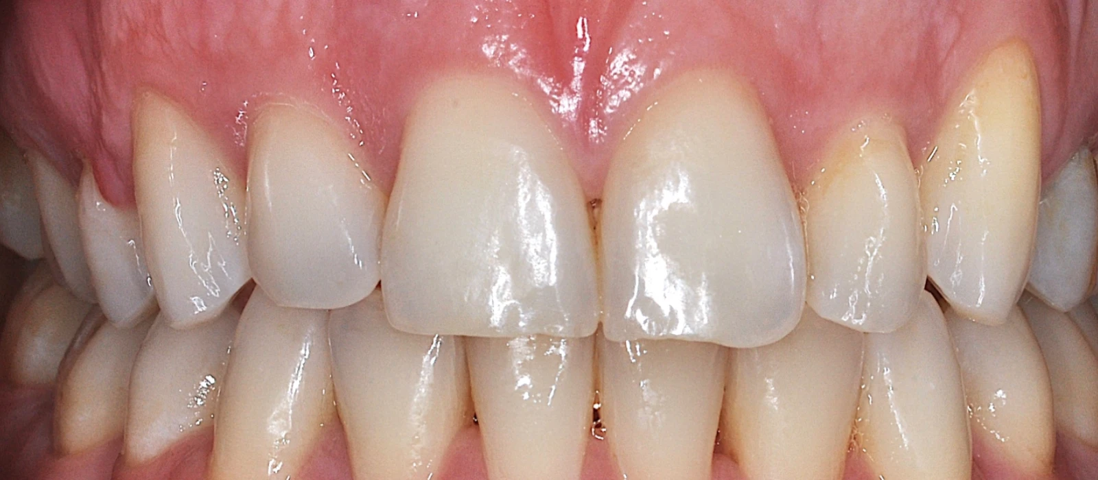 Orthodontics I