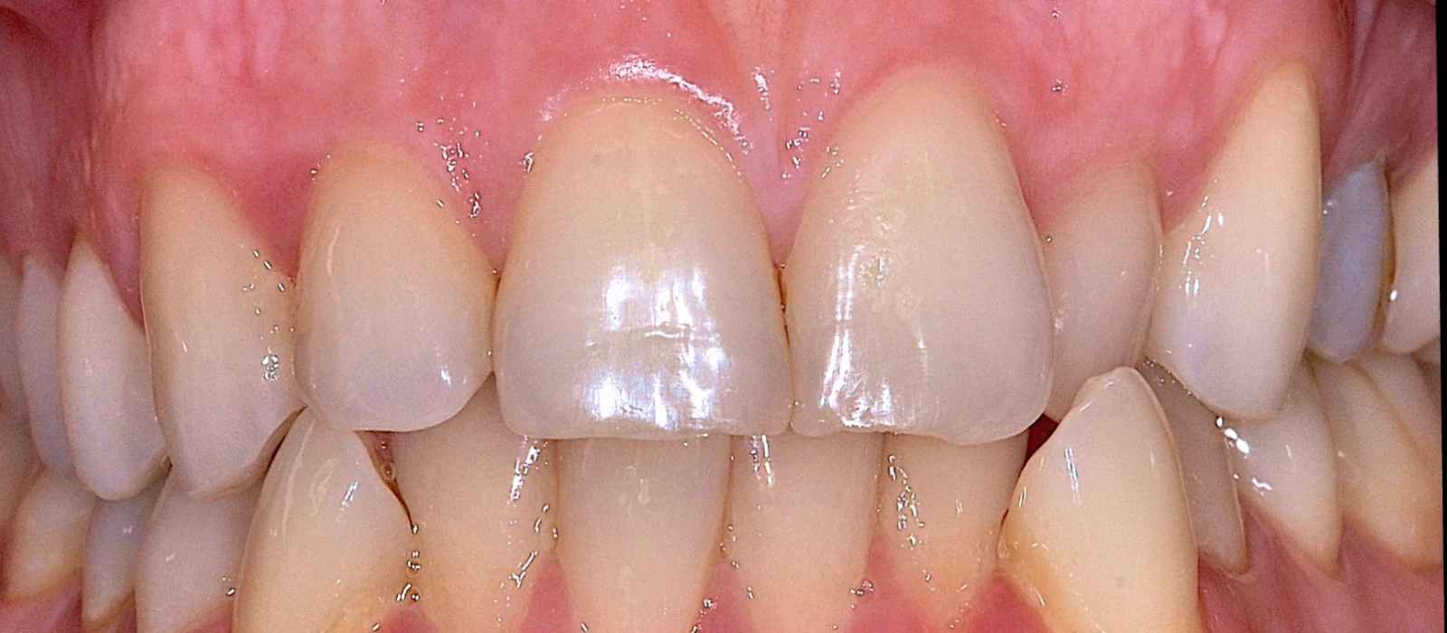 Orthodontics I