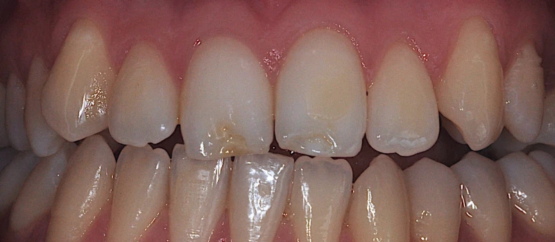 Orthodontics II Before